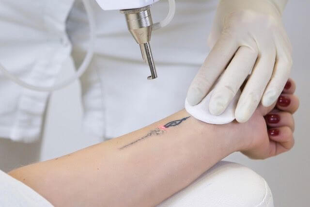 Laser Tattoo Removal Clinic – Prime Rosanna Location Low Overheads & High Margins